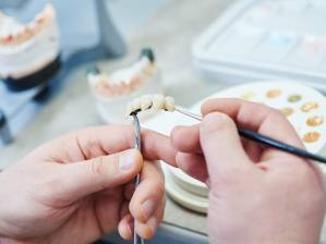 Hochwertiger Zahnersatz – gefertigt in unserem Haus